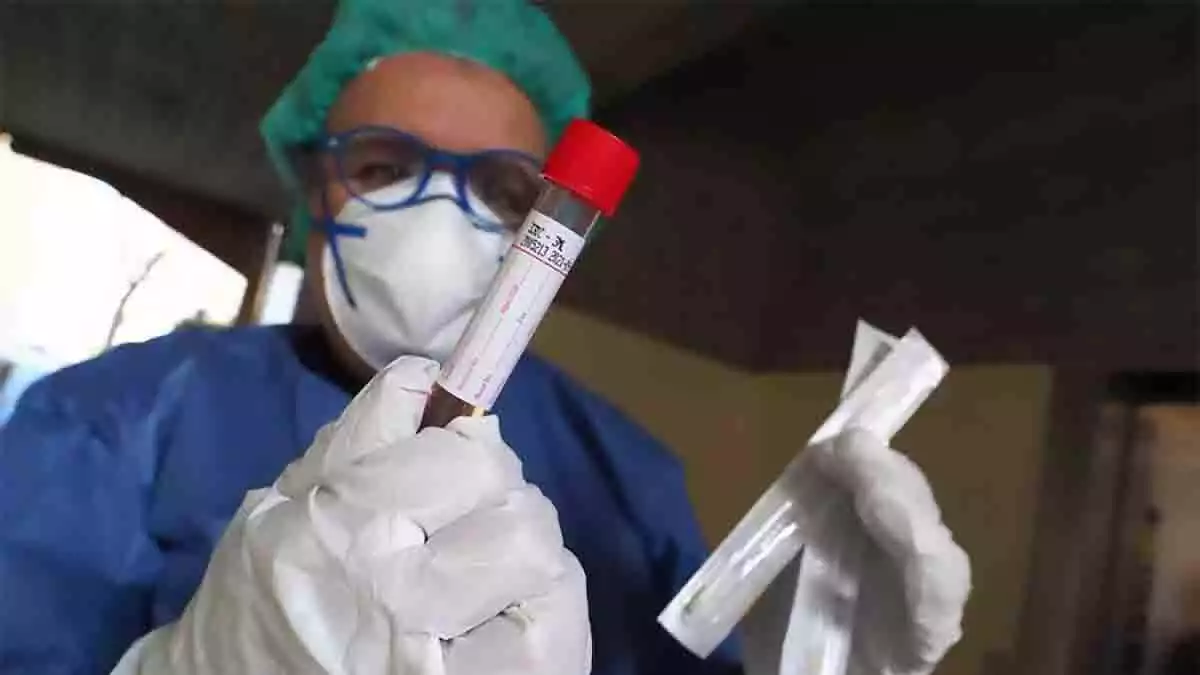 A doctor with a Coronavirus test in his hands.