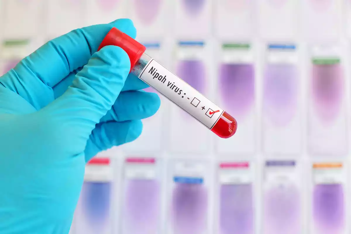 A Nipah virus blood sample tested positive